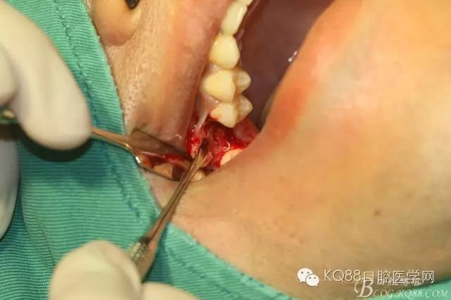 640.webp (10).jpg 640.webp (10).jpg