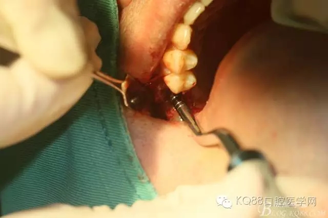 640.webp (25).jpg 640.webp (25).jpg