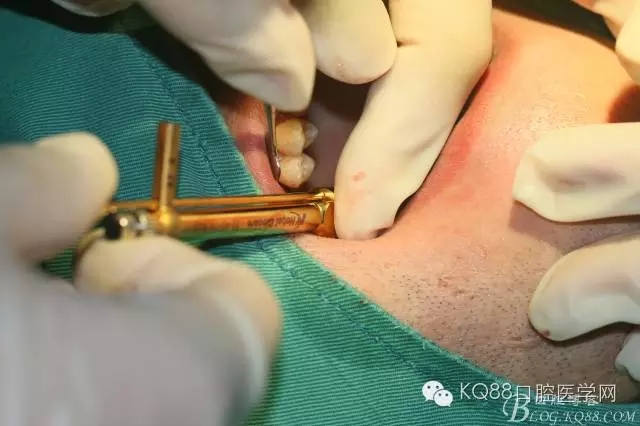 640.webp (28).jpg 640.webp (28).jpg