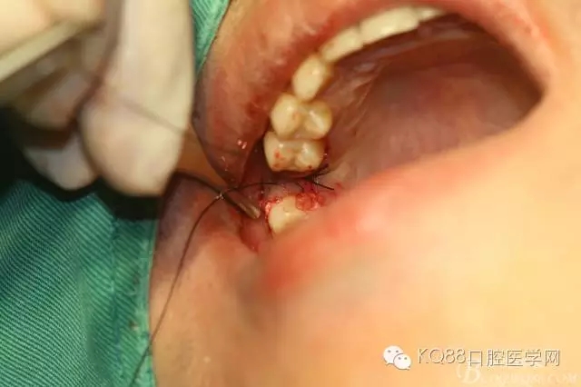 640.webp (32).jpg 640.webp (32).jpg