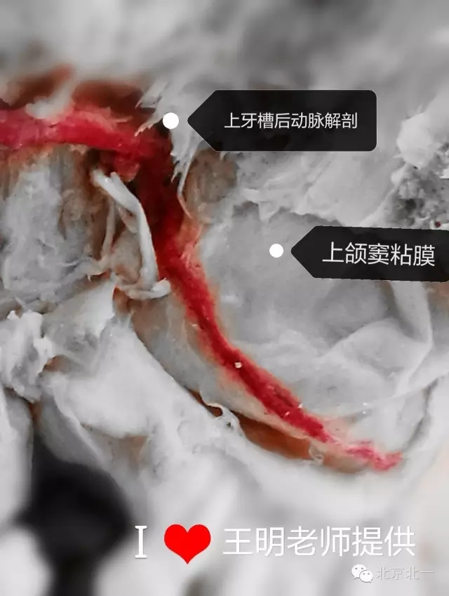 640.webp (2).jpg 640.webp (2).jpg