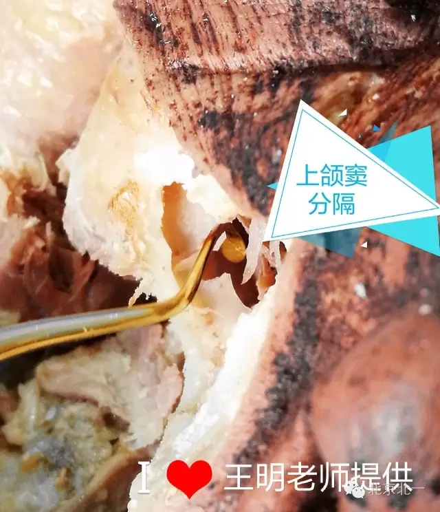 640.webp (10).jpg 640.webp (10).jpg