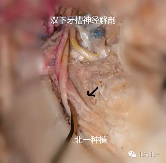 640.webp (16).jpg 640.webp (16).jpg