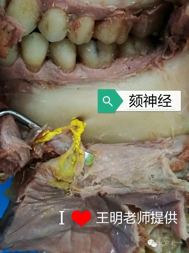 640.webp (17).jpg 640.webp (17).jpg