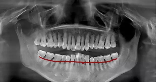 640.webp (22).jpg 640.webp (22).jpg