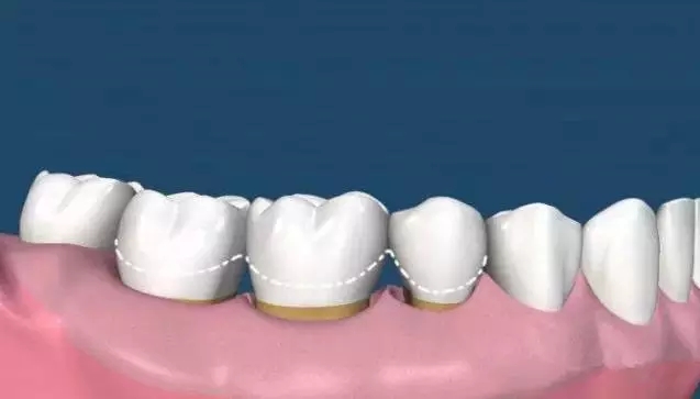 640.webp (31).jpg 640.webp (31).jpg