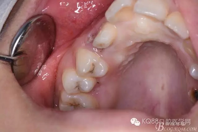 640.webp (2).jpg 640.webp (2).jpg