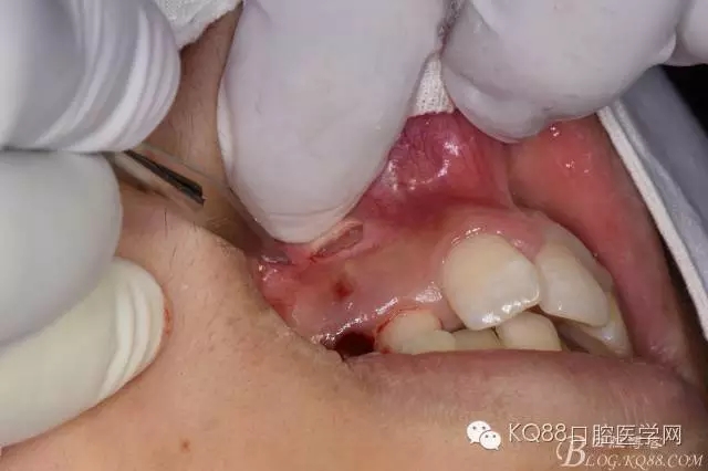 640.webp (3).jpg 640.webp (3).jpg