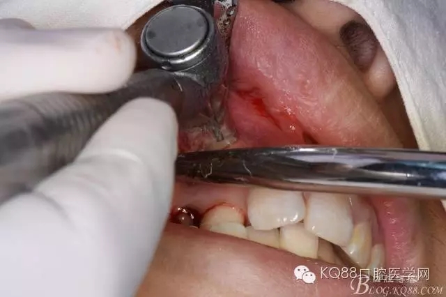 640.webp (8).jpg 640.webp (8).jpg