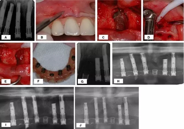 640.webp (21).jpg 640.webp (21).jpg