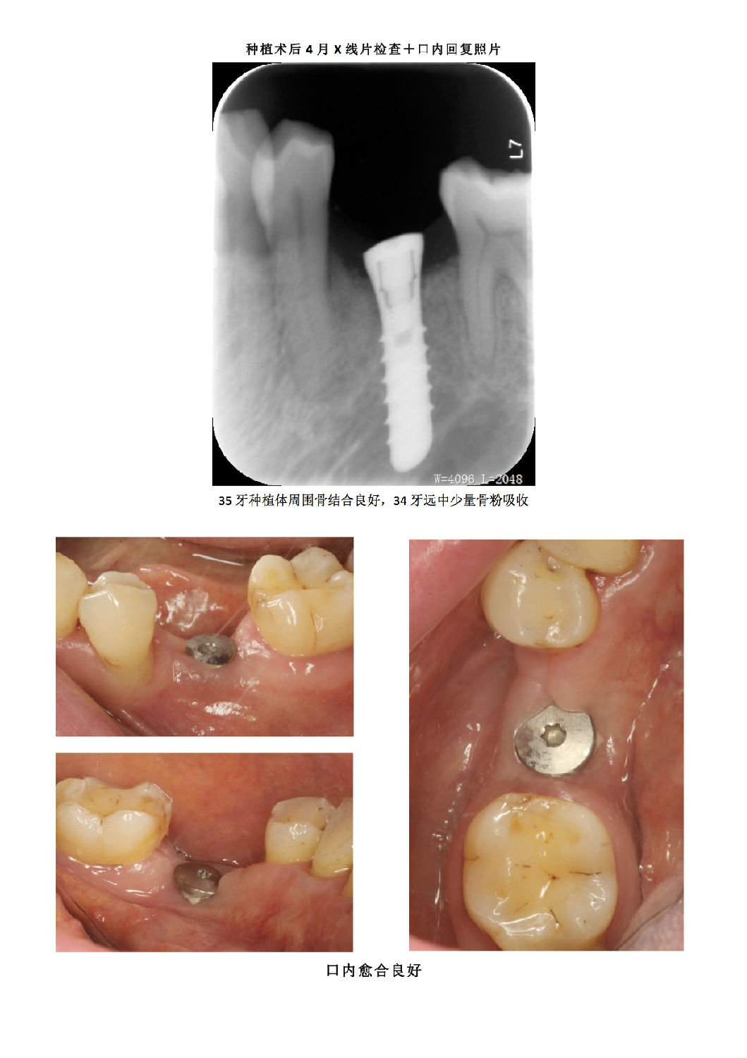 befa09a2-30b3-45be-a9bb-50d05d308a5e.jpg befa09a2-30b3-45be-a9bb-50d05d308a5e.jpg