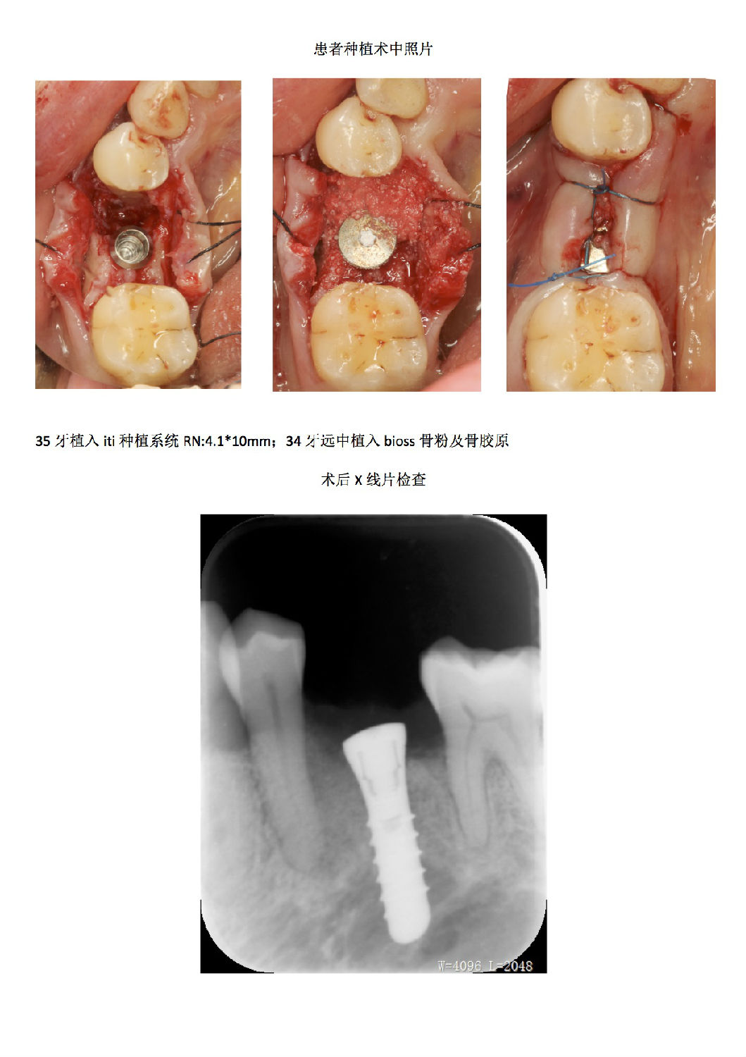 484cbaa3-25c8-4093-ab1d-adf204d27977.jpg 484cbaa3-25c8-4093-ab1d-adf204d27977.jpg