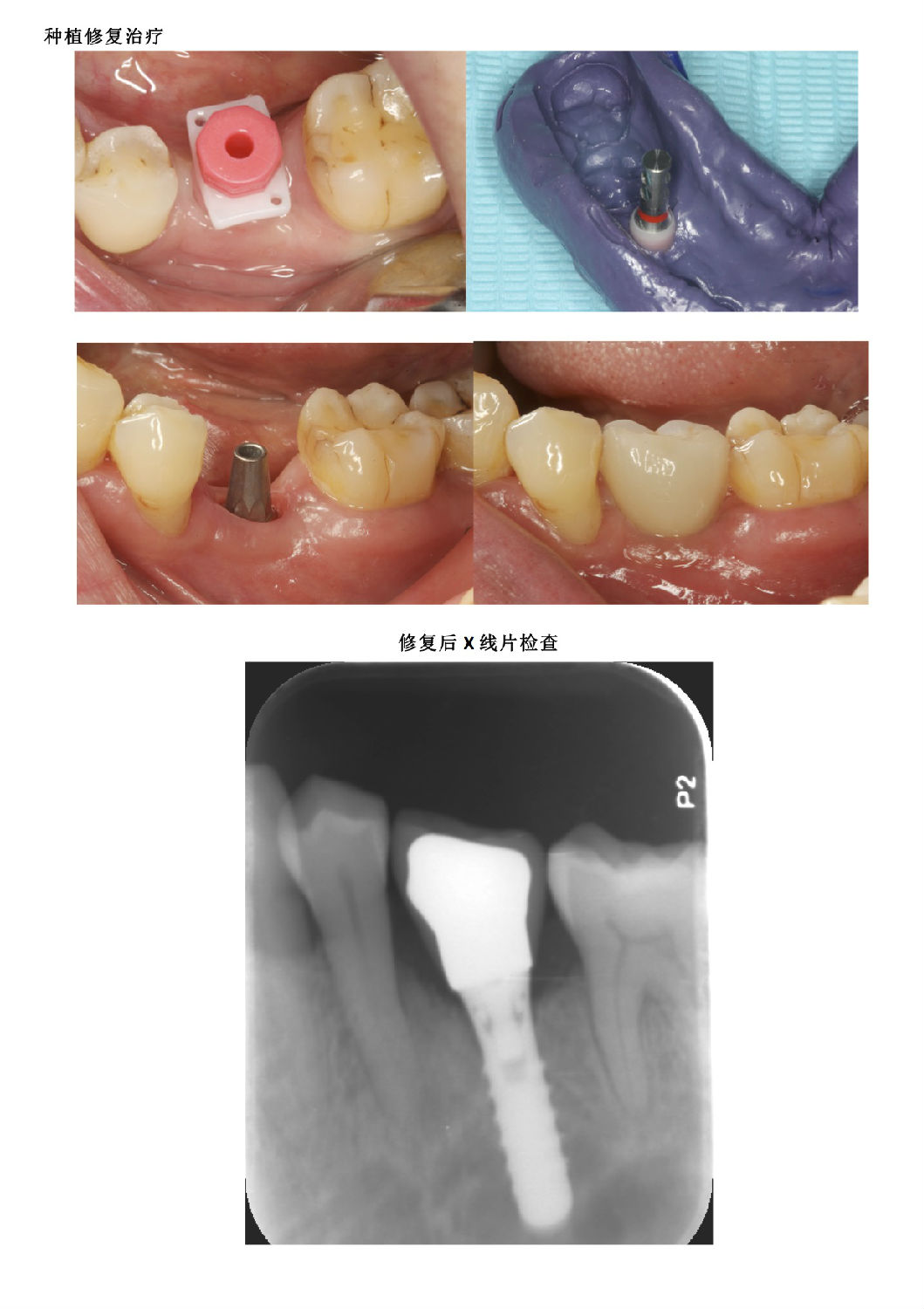 a66fb007-4d8d-4440-805b-e3f68474e13f.jpg a66fb007-4d8d-4440-805b-e3f68474e13f.jpg