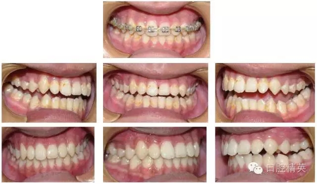 640.webp (7).jpg 640.webp (7).jpg