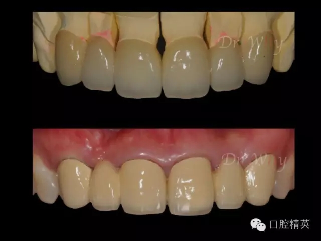 640.webp (11).jpg 640.webp (11).jpg