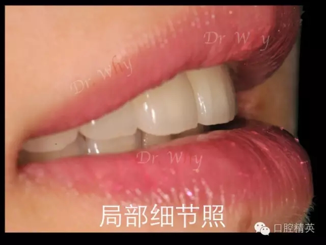 640.webp (16).jpg 640.webp (16).jpg