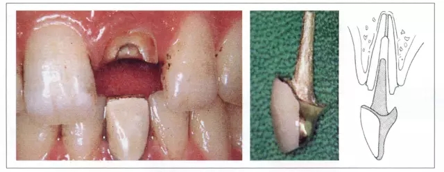 640.webp (5).jpg 640.webp (5).jpg