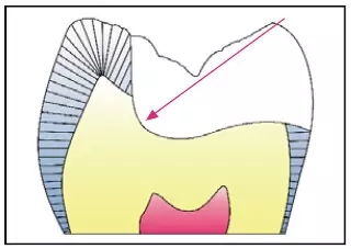 640.webp (5).jpg 640.webp (5).jpg