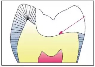 640.webp (6).jpg 640.webp (6).jpg