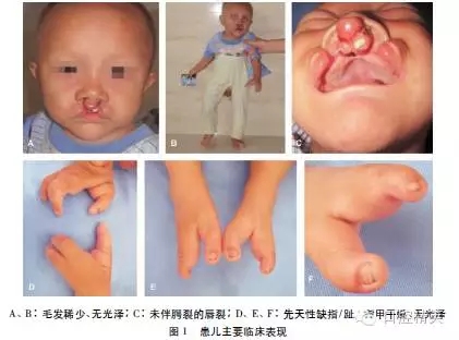 640.webp (8).jpg 640.webp (8).jpg