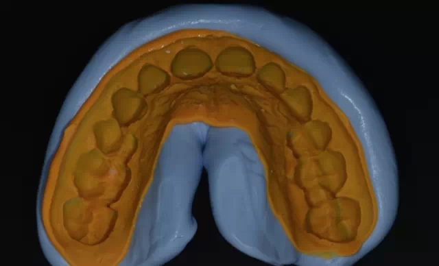 640.webp (3).jpg 640.webp (3).jpg