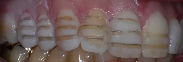 640.webp (5).jpg 640.webp (5).jpg