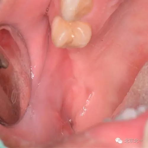 640.webp (10).jpg 640.webp (10).jpg