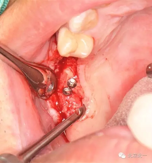 640.webp (11).jpg 640.webp (11).jpg