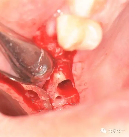 640.webp (14).jpg 640.webp (14).jpg