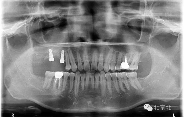 640.webp (22).jpg 640.webp (22).jpg