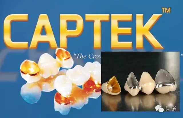 為何烤瓷牙的價格從幾百元至數(shù)千元不等？告訴您11種烤瓷牙的特點(diǎn)、價格及優(yōu)缺點(diǎn)