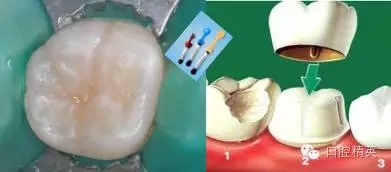 640.webp (4).jpg 640.webp (4).jpg