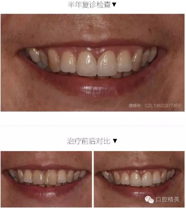 640.webp (15).jpg 640.webp (15).jpg