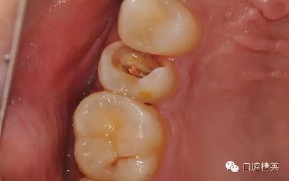 640.webp (2).jpg 640.webp (2).jpg