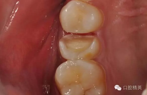 640.webp (3).jpg 640.webp (3).jpg