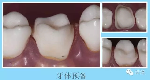 640.webp (2).jpg 640.webp (2).jpg