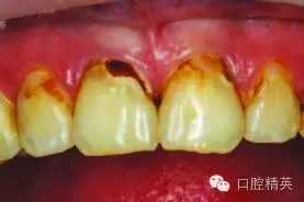 640.webp.jpg 640.webp.jpg