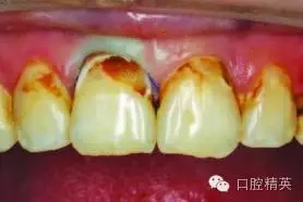 640.webp (4).jpg 640.webp (4).jpg