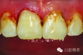 640.webp (7).jpg 640.webp (7).jpg