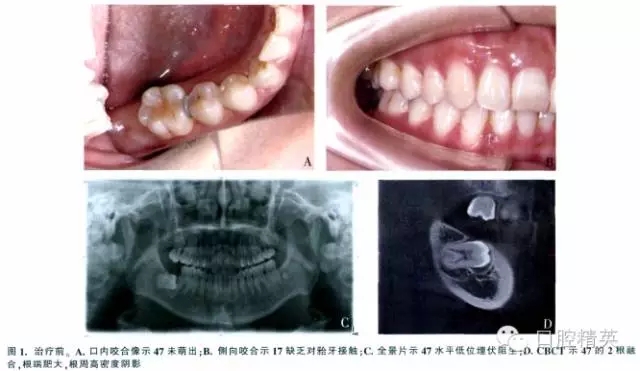 640.webp (13).jpg 640.webp (13).jpg