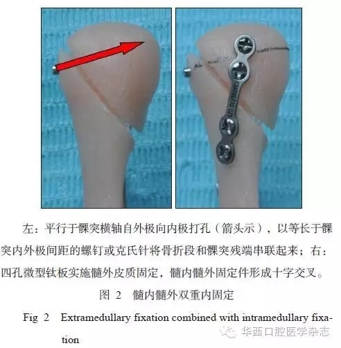 640.webp (17).jpg 640.webp (17).jpg