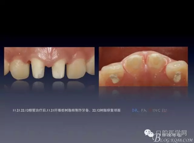 640.webp (3).jpg 640.webp (3).jpg