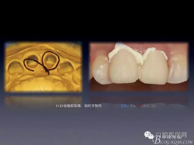 640.webp (4).jpg 640.webp (4).jpg