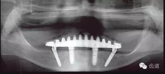 640.webp (3).jpg 640.webp (3).jpg