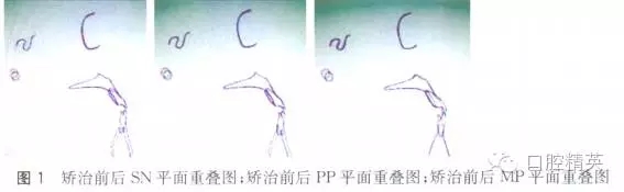 640.webp.jpg 640.webp.jpg