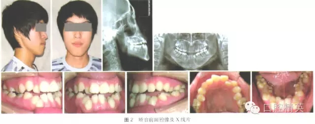 640.webp (1).jpg 640.webp (1).jpg