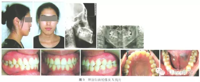 640.webp (4).jpg 640.webp (4).jpg