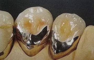 0.webp (2).jpg 0.webp (2).jpg