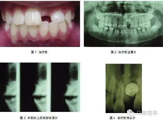 640.webp (3).jpg 640.webp (3).jpg