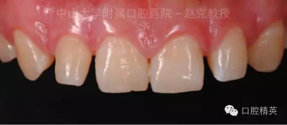 640.webp (3).jpg 640.webp (3).jpg